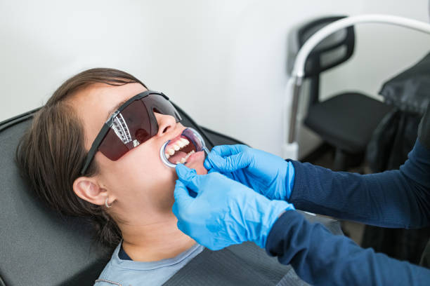 Best Emergency Wisdom Tooth Extraction in Lake Sarasota, FL